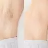 Deodorant that stops hair growth by Epil Star