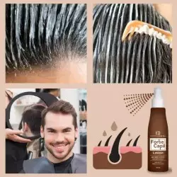 Hair growth vitamins by Forte Capil - 3 Months Supply